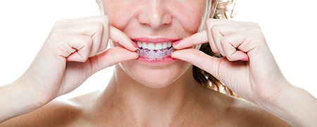 vida sana-bruxismo-iStock_000023502119_Large